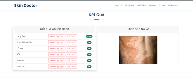 SV FPT Edu ứng dụng AI chẩn đoán bệnh ngoài da - 2